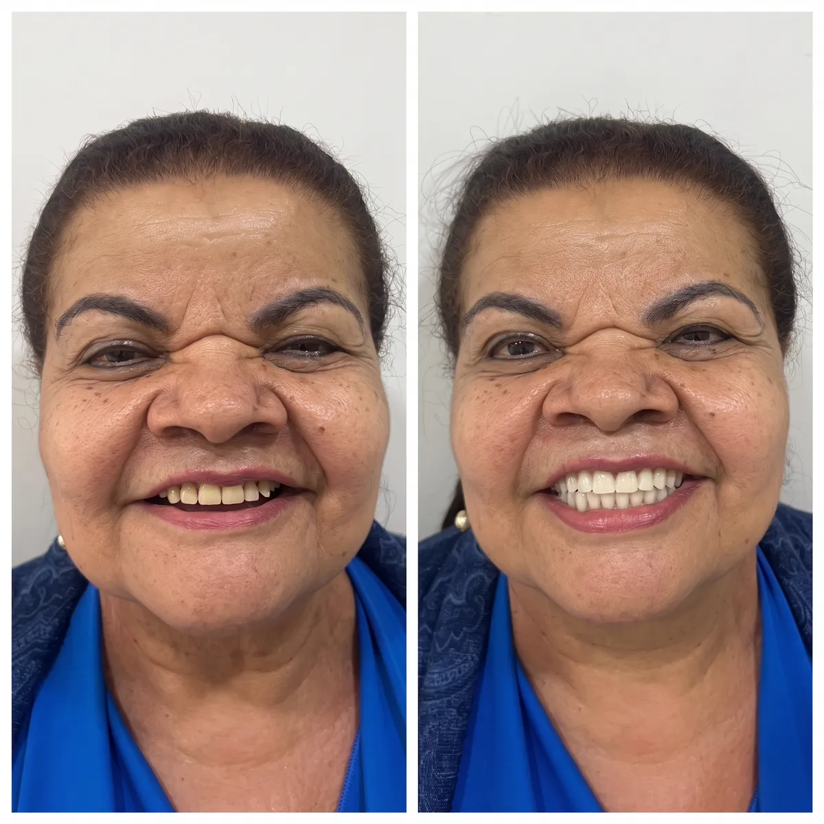 Protocolo sobre Implantes - Dra. Tarsila Rocha